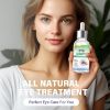 Picture of Stye Eye Treatment, Stye Eye Serum, 1 Fl.oz