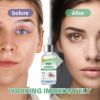 Picture of Stye Eye Treatment, Stye Eye Serum, 1 Fl.oz