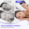 Picture of Nasal Strips for Snoring, 100 Count Extra Strength Anti Snoring Device for Snoring Solution, Relieve Nasal Congestion for Men Women, Improved Airflow and Comfortable Fit