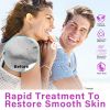 Picture of Acid 12% Facial Serum, Acid Face Cream, Skin Care