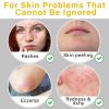 Picture of Manuka Honey Cream Honey Eczema Cream – Organic Eczema Honey & Collodial Oatmeal Moisturizer for Soothing, eczema, Dry & Itchy Skin – Face & Body Eczema Lotion, 2oz