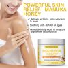 Picture of Manuka Honey Cream Honey Eczema Cream – Organic Eczema Honey & Collodial Oatmeal Moisturizer for Soothing, eczema, Dry & Itchy Skin – Face & Body Eczema Lotion, 2oz