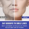 Picture of Smile Line Patches, Anti Wrinkle Patches, Face Lift Tape for Smoothing Smile Lines, Wrinkles Around the Mouth & Other Fine Facial Lines, 16PCS